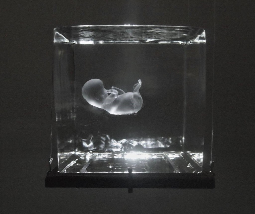 Eric Hess; "Fragile", which is a glass fetus in a 12 inch square block of ice. When the ice melts the fetus falls to the floor below and breaks, a tearful reality.